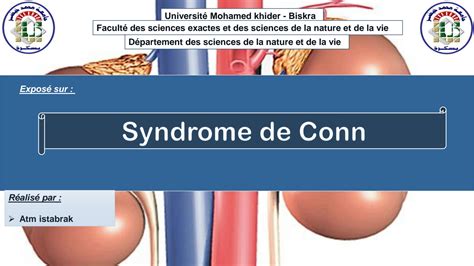Toradh íomhá ar Conn Syndrome