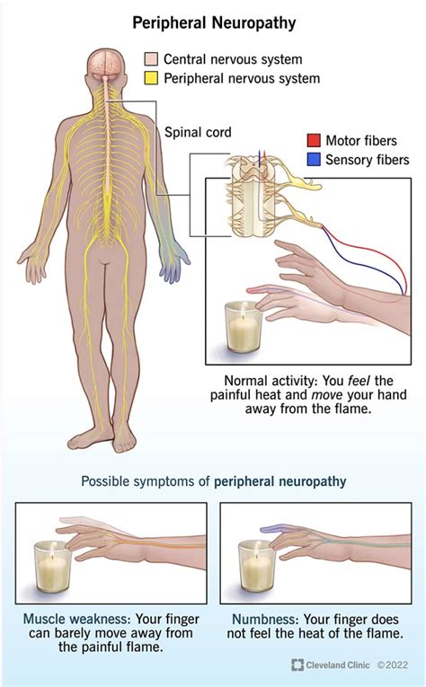 E Peripheral Motor Nerves に対する画像結果