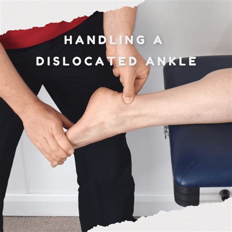 Image result for Dislocated Ankle