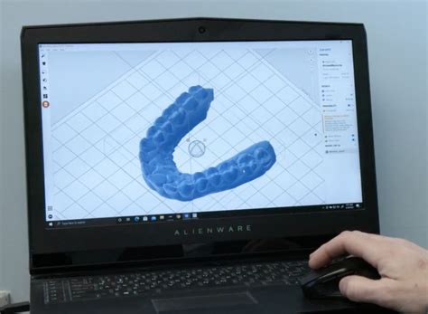 Image result for 3D Teeth Scanner