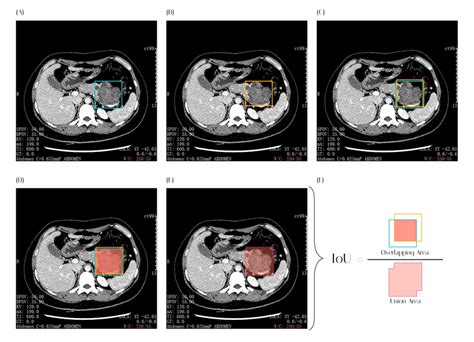 Résultat d’images pour Intersection Over Union Bounding Box