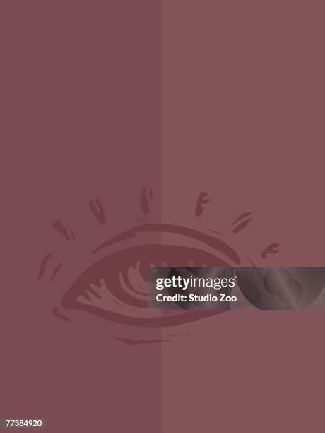 Image result for Eye Pops Out of Socket