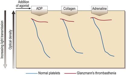 Toradh íomhá ar Normal Platelet Aggregation Graph