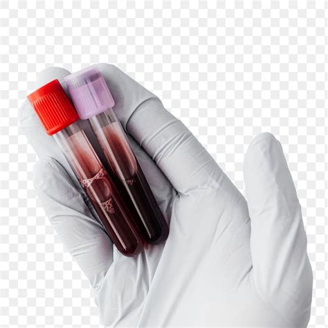 Blood Test Image PNG No Background に対する画像結果