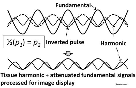 Image result for Asi Alternating Pulse Modulation