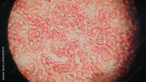 Image result for Blood Fluid Matrix Microscope