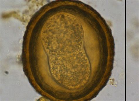 Image result for Size Parasites