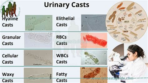 Urine Casts に対する画像結果