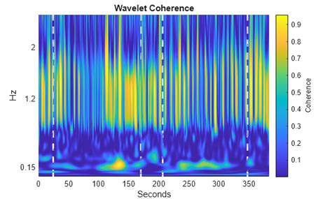 Image result for MATLAB Wavelet Transform Filter Lana