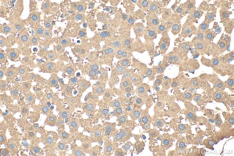 Image result for apoB in Liver Western Blot