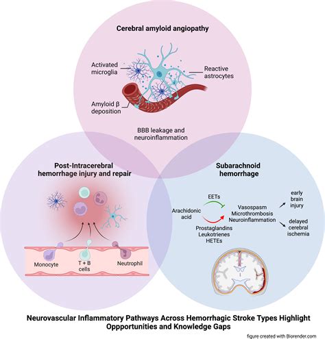 Toradh íomhá ar Inflammation Pathophysiology