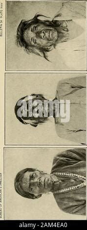 Image result for Apache Scalps