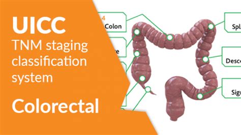 Colon Cancer Classification に対する画像結果