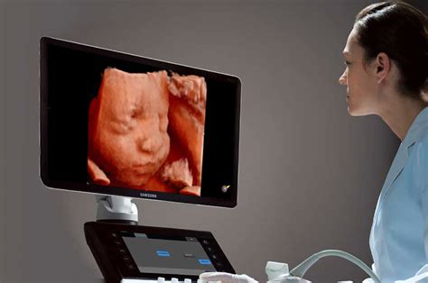 Image result for 3D/4D Ultrasound Exam