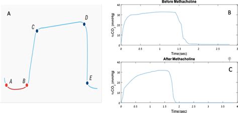 Toradh íomhá ar Normal Capnography Waveform