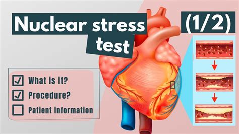 Toradh íomhá ar Stress Test Procedure