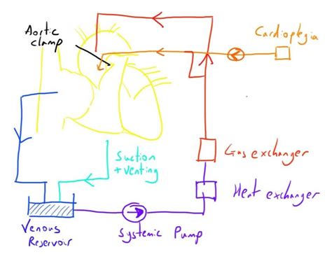 Image result for CPB Surgery