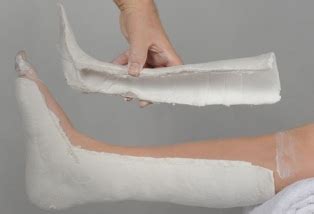 Image result for Bivalve Cast