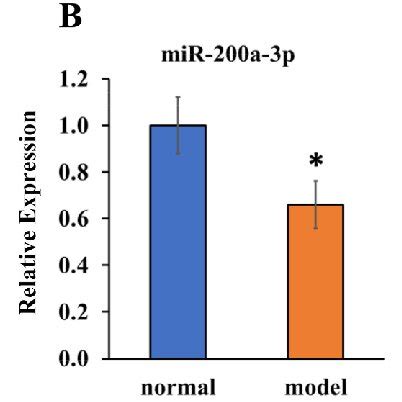 Image result for Single Row RCR