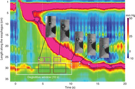 Image result for Normal Manometry