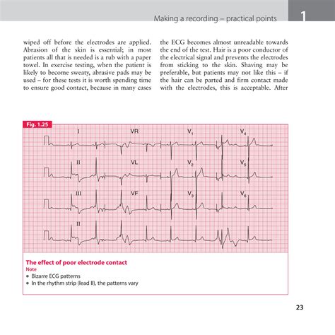 Easy ECG Guide に対する画像結果