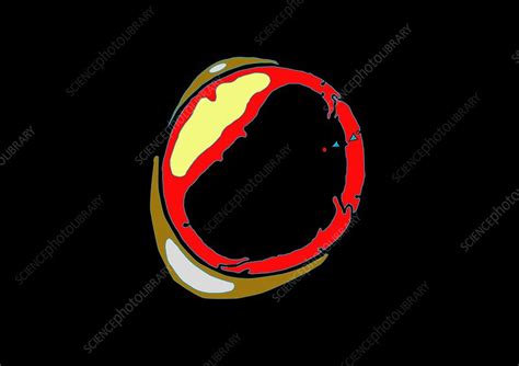 Image result for Capillary Drawing