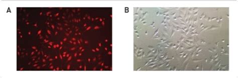 RNAiMAX Reverse Transfection に対する画像結果