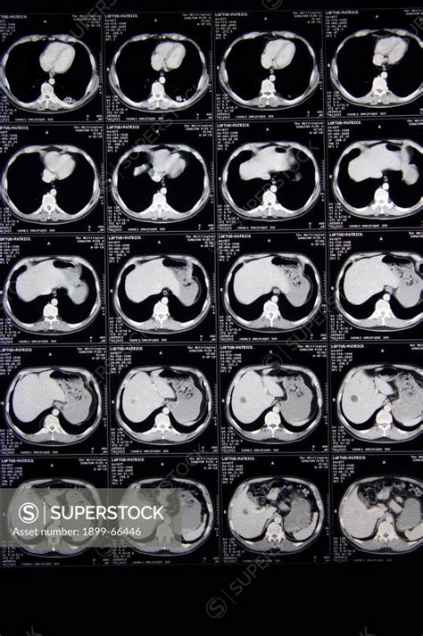 Image result for MRI Scanner Prefrontal Cortex
