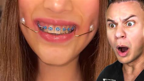 Image result for How to Dimples in One Hour