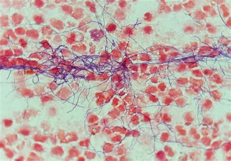 Blood Slide Diagnostic に対する画像結果