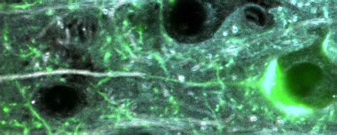 Mouse Brain Sample Under Microscope に対する画像結果