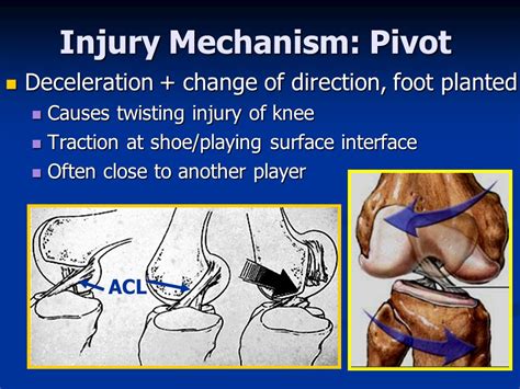 Image result for Twisting Foot Mechanism