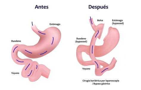 Image result for Bypass Sensor for a Backflow