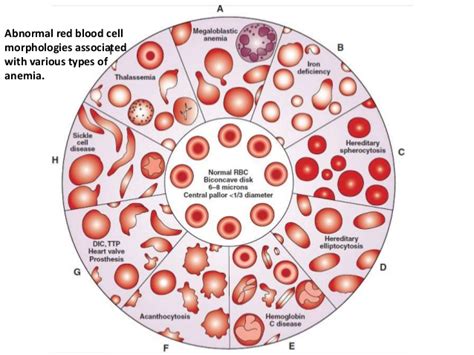 Lecture Notes in Medical Technology: Lecture #8: Red Blood Cell Disorders