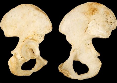 Labelled Ilium に対する画像結果