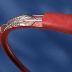 Polyether Block に対する画像結果