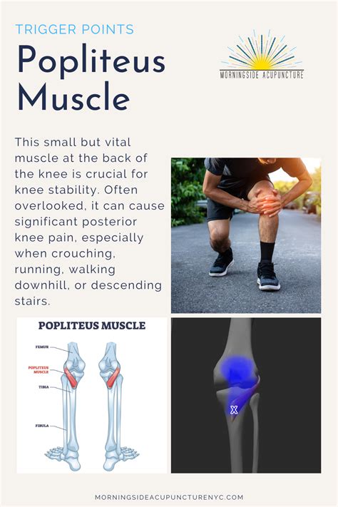 Image result for Popliteus Muscle Function Test