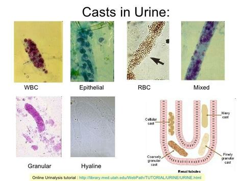 Urine Casts に対する画像結果