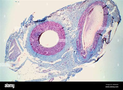 Transverse Section of Vein and Artery に対する画像結果