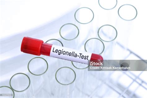 Image result for Legionella Testing in Laboratory