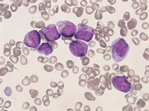 Myelocyte Microscope に対する画像結果