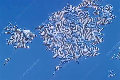 Lactobacillus Micrograph に対する画像結果