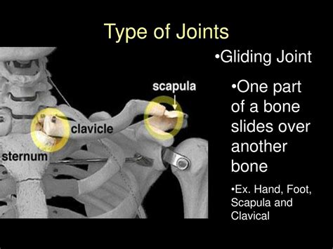 Image result for Structure of Gliding Joint