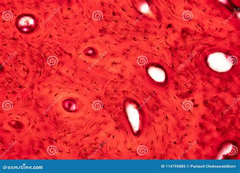 Image result for Compact Bone Under Microscope