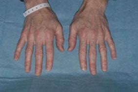 Image result for Handextravert Hand Sign