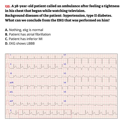 Image result for EKG Tech Practice Test