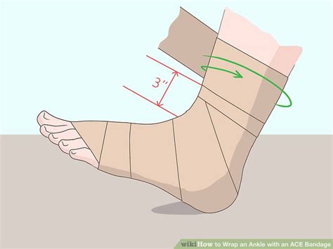 Toradh íomhá ar How to Wrap Ankle Sprain