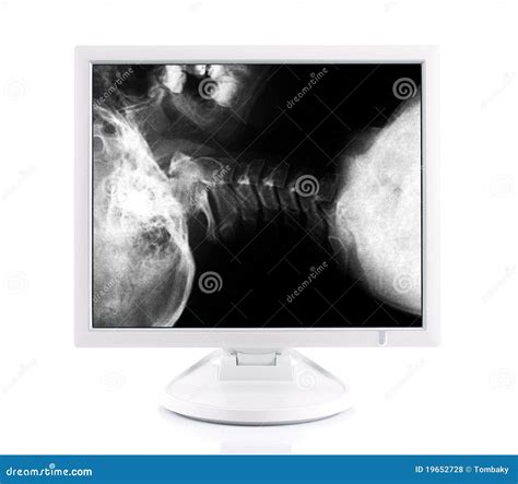 Image result for Computer X-ray Map