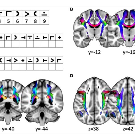 Image result for Digit Symbol Test Examples