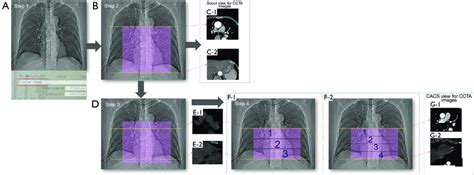 Image result for Scanner Flowchart